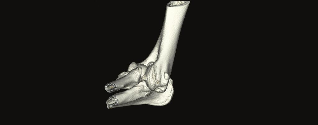 Elbow dysplasia What is elbow dysplasia? Elbow dysplasia means abnormal development of the elbow joint.