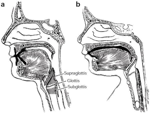 Obligate nasal breathing in the newborn Intranarial position of the larynx, secure a continuous airway