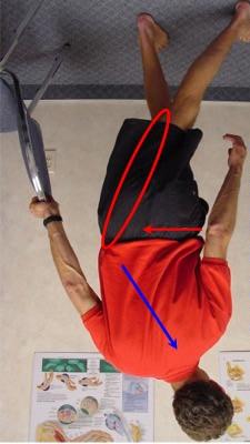 Spondylolisthesis, where the spine is easily compressed in extension. Therefore this exercise should not be performed unless in these types of conditions unless expressly recommended by your doctor.