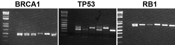 To generate the double and triple genetic mice (TP53/BRCA1; Ovgp1::Cre-ERT2 and TP53/Rb1; Ovgp1::Cre-ERT2), we purchased these mice from the