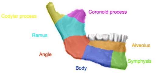 10- Complicated or complex: A fracture in which there is considerable injury to the adjacent soft tissues or adjacent parts (nerve, joint ); may be simple or compound Since the mandible itself