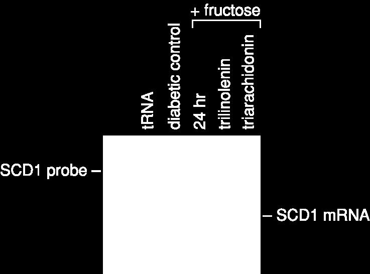 Fructose Induces SCD1: PUFAs Repress