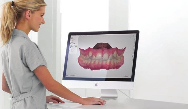 their offering. 3Shape makes this easy by providing digital workflows for either in-house design or through direct access to expert orthodontic design services*.