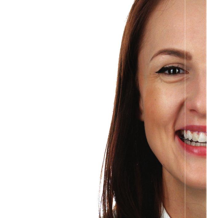 smile designs with photo-realistic simulation to show the patient.