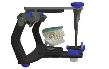 virtual articulator reducing the need for manual adjustments. Works with any articulator.