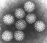 What is a Virus? Non-living particle WHY?