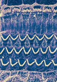 FETTIPLACE THE TRANSFORMATION OF SOUND STIMULI INTO ELECTRICAL SIGNALS 19 Figure 2 A scanning electron micrograph of the surface of the organ of Corti shows three rows of V-shaped outer hair cell
