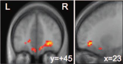 Neural activity in OFC during action selection for reward, showing a change in response properties as a function of the value of the outcome with each action.