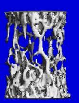 Results of 3D reconstruction images demonstrated significant spinal destruction in cohorts of