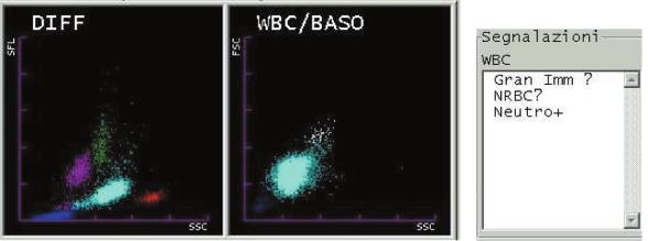 Fig. 5 WBC/BASO and DIFF scattergrams from XT-2000i WBC = 7.4 10 9 /L.