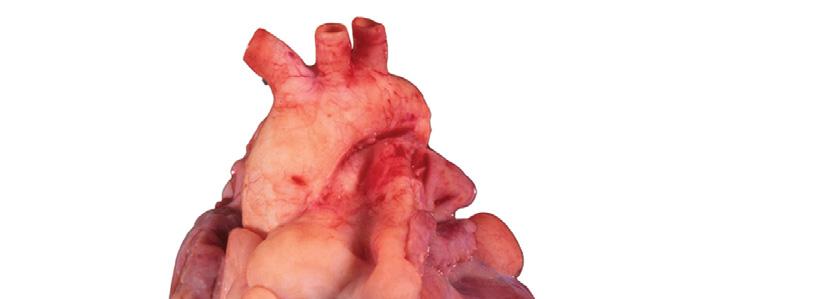 Figure 19.5a Gross anatomy of the heart.