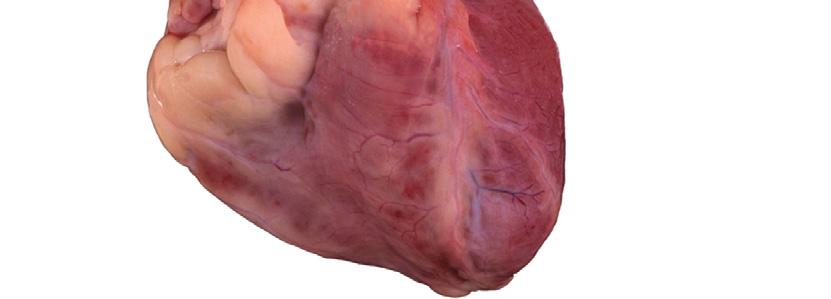 (pericardium removed) Auricle of left atrium Left Anterior interventricular sulcus Apex of heart (left ) Heart Chambers