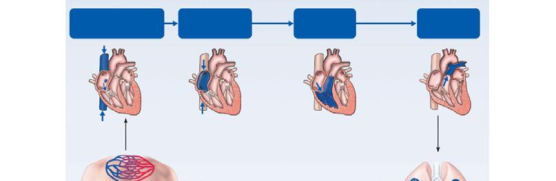 Blood Flow Through the Heart (SVC) Inferior vena cava (IVC) Coronary sinus atrium Tricuspid semilunar trunk SVC Coronary sinus atrium IVC Oxygen-poor blood To heart returns from
