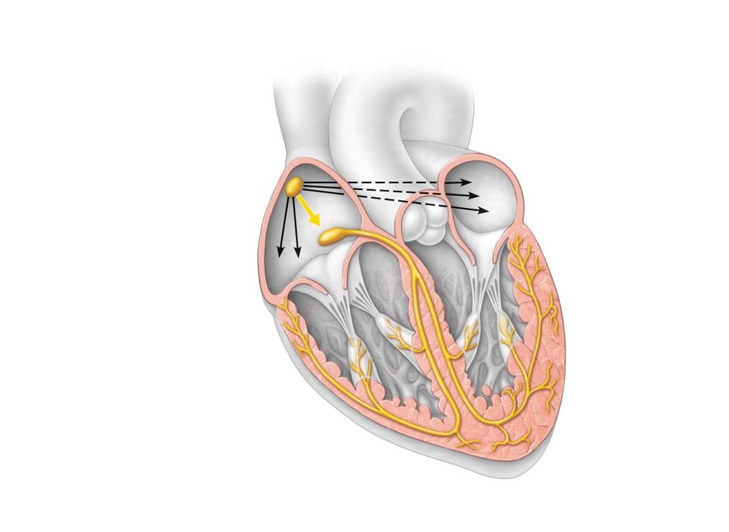 Superior vena cava Right atrium 1 The sinoatrial (SA) node (pacemaker) generates impulses. Internodal pathway 2 The impulses pause (0.1 s) at the atrioventricular (AV) node.