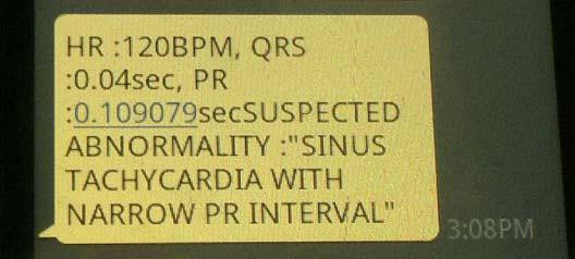 The enitire set up was tested for abnormal conditions. When the heart rate went beyond its range of 60-100 BPM, the following message was transmitted by the system via SMS.