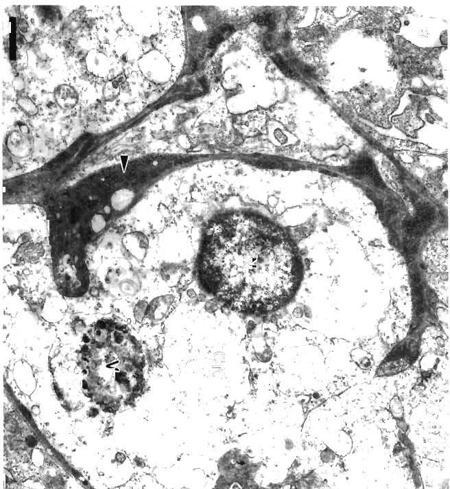 Cells that were heavily infected with nucleocapsids often appeared 'empty' with degenerate cellular components (Fig. 3).