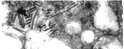Spann et al.. Yellowheadlike virus 173 Fig. 4. Penaeus monodon. Stnated (arrow) GAV nucleocapsids free in the cytoplasm of a lymphoid organ cell.