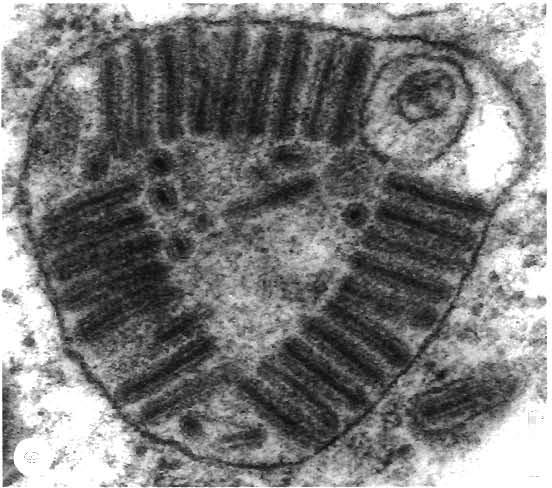 8) and contained virions released by rupture of the plasma membrane (Fig. 9).