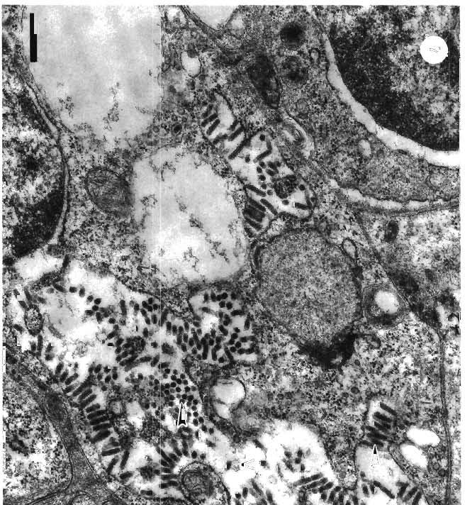 174 Dis Aquat Org 31: 169179,1997 Fig. 7. Penaeus monodon. GAV virions (arrowheads) loosely and randomly enclosed in a large vacuole (V) in the cytoplasm of an infected lymphoid organ cell.
