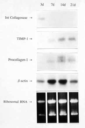 Matrix degrading metalloproteinase (MMP) TIMP MMP activity inhibite No matrix degradatio occurs GELATIN SEPHAROSE CHROMATOGRAPHY OF HSC CONDITIONED MEDIA Gelatinase activity in culture media