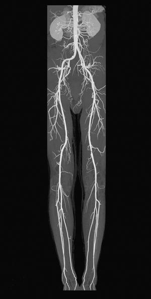 CT Angiography and MR