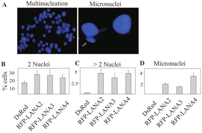 VOL. 80, 2006 KSHV-ENCODED LANA INDUCES CHROMOSOMAL INSTABILITY 701 FIG. 3. Induction of multinucleation and micronuclei in LANA-expressing Rat1 cells.