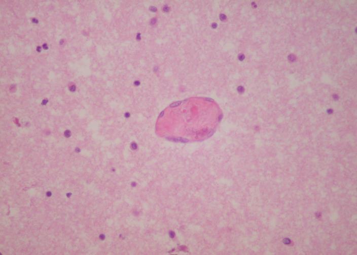 oval or bean-shaped nuclei, small conspicuous nucleoli.