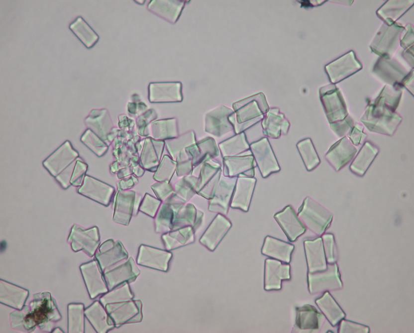 retain their characteristic features in fixed urine, such as triple phosphate crystals with coffin lid configurations. (Fig.4.5). Fig.4.5. Triple phosphate crystals with coffin lid configuration.