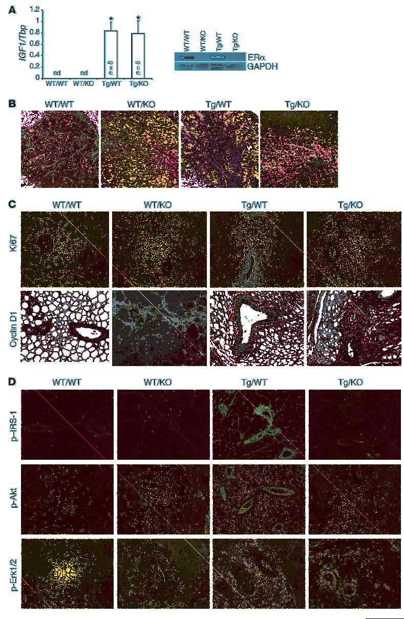 research article Figure 6 Analysis of mammary glands from 4- to 5-week-old bitransgenic BK5.IGF-1 ERKO mice, which overexpress IGF-1 but lack ERα.