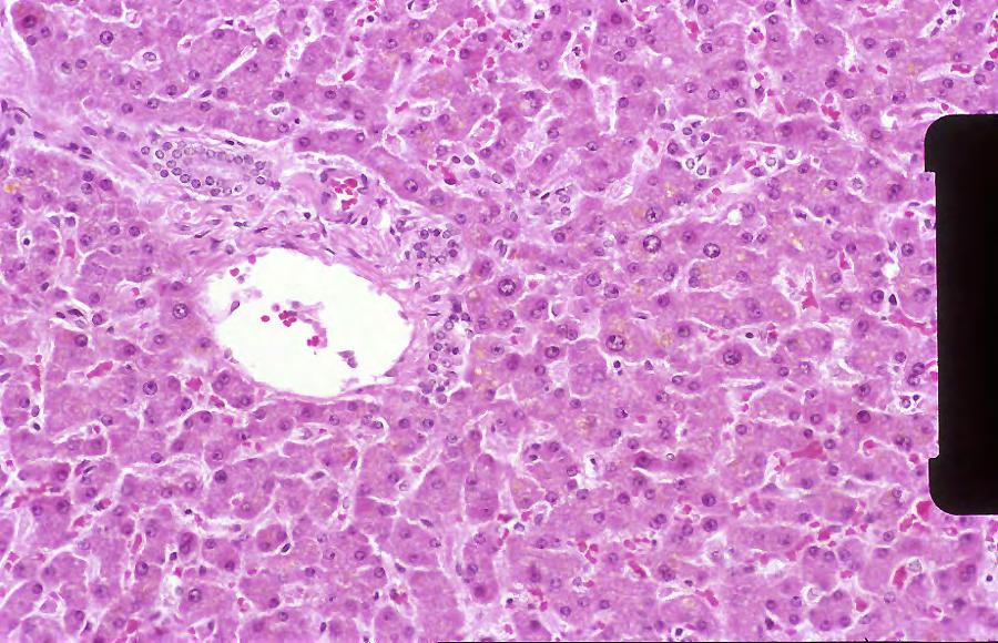Sometimes accumulations of various substances may be seen in the cytoplasm of cells. This may be physiological or pathological. Normal liver, medium power view.
