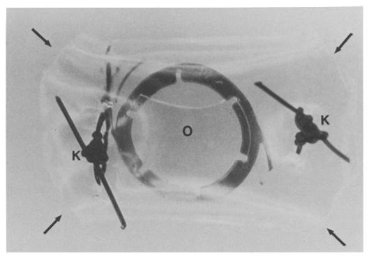 Graefe's Arch Clin Exp Ophthalmol (1983) 221:55-60 Graefe's Archive for Clinical and Experimental Ophthalmology Springer-Verlag 1983 Artificial anterior chamber for the growing of membranes on lens