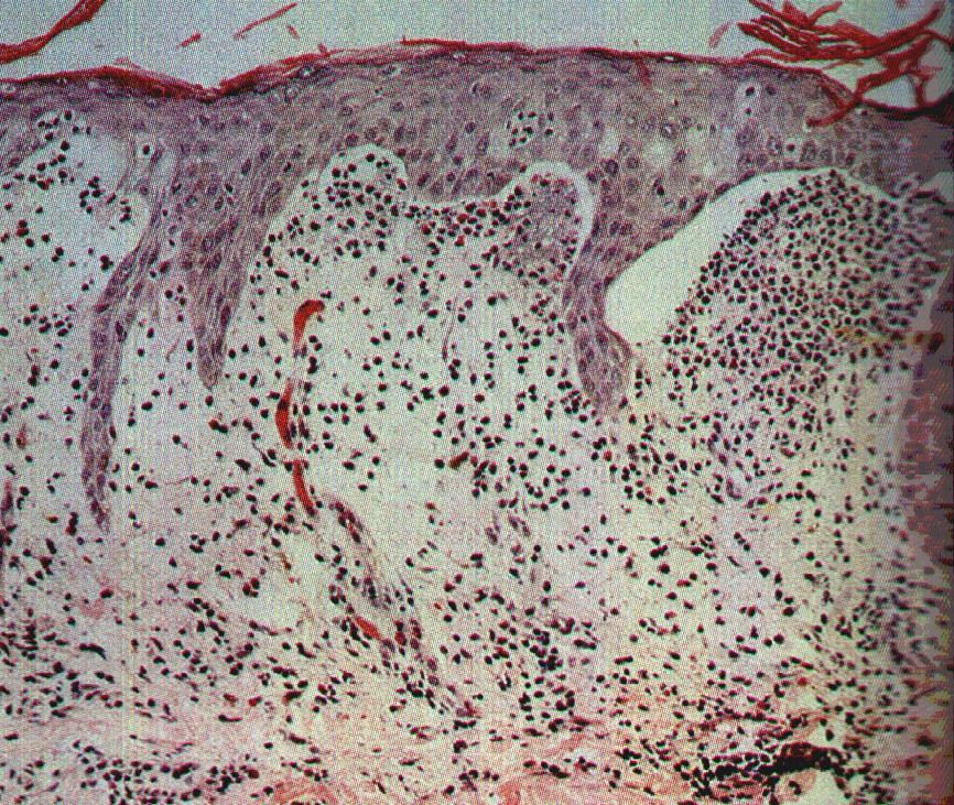 Histological picture of