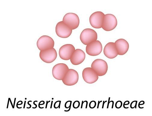 Gonorrhea - Epidemiology Second-most frequentlyreported STI in Ontario Highest in males aged 20-29 and females aged 15-24. Increased risk in MSM.