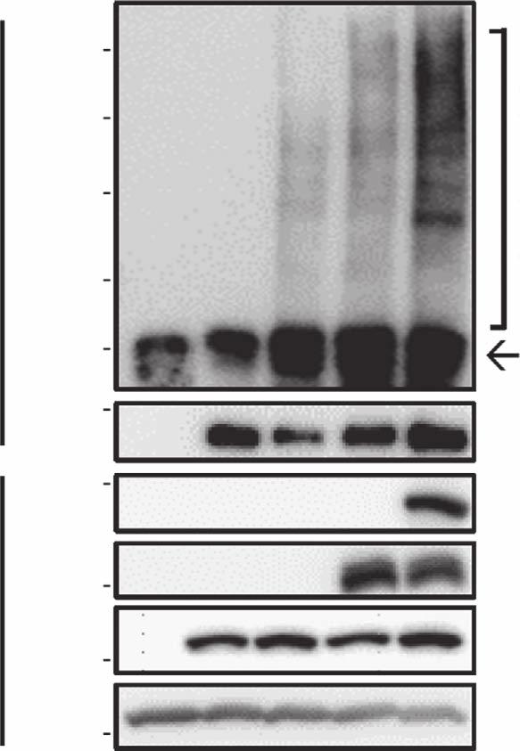 Total cell lysates were analysed by western blotting with indicated antibodies. (b) HEK93T cells were transfected with FLAG-MDM, nfoxo-myc, and GFP- expression vectors.