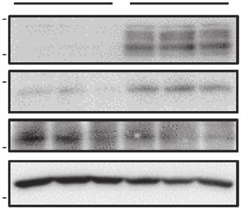 The levels of the mrna (a) and protein (b) were determined using qrt-pcr with normalization to TBP mrna levels and western blotting, respectively. Data are represented as mean ±s.d., N ¼ 3 for each group.