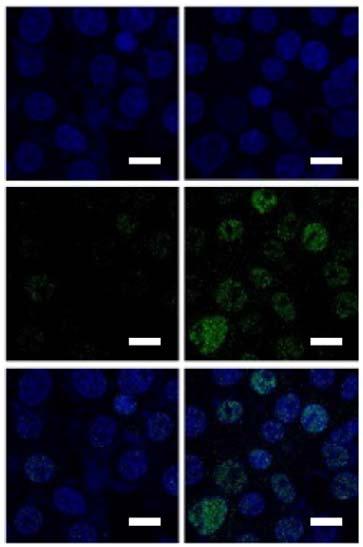 .8.6.4. sicon si sifoxo si sifoxo..8.6.4. FOXO sicon si sifoxo si sifoxo Figure 4 regulates FOXO protein level. (a,b) Mouse primary hepatocytes were adenovirally infected with or Ad-.