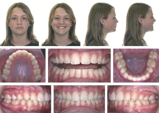 much healthier. Therefore, for this patient the initial decision was easy.