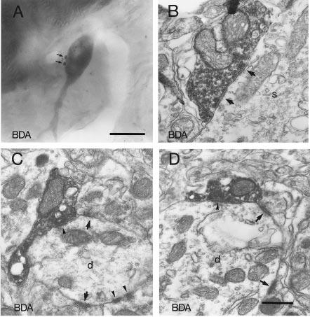 362 J. J. Hanley and J. P. Bolam Fig. 5. Light (A) and electron (B D) micrographs of BDA-positive profiles in the globus pallidus.