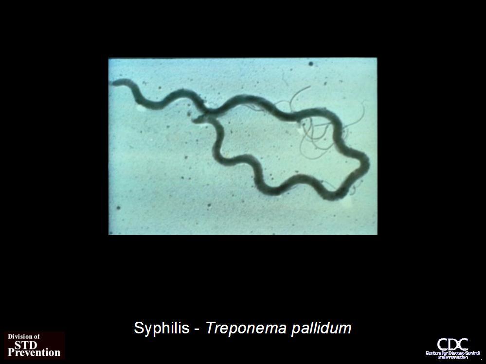 Syphilis The Basics Re-emerging