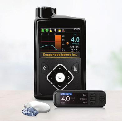 THE MINIMED 640G HOW DOES IT WORK? PROTECTING YOU TO STAY IN TARGET The MiniMed 640G System 3 keeps you in target range with custom basal profiles and an in-built bolus wizard.