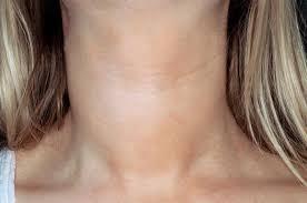 Thyroid swelling Goitre/ mass Thyroid mass or asymmetric