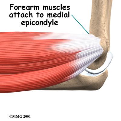 Any activities that stress the same forearm muscles can cause symptoms of golfer's elbow.