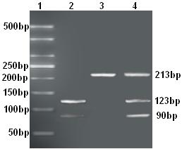Association between LMNA rs4641 and DCM 15431 Figure 1. Detection of LMNA gene polymorphism by PCR-RFLP. Lane 1: 50-bp DL 2000 Marker; Lane 2: CC genotype; Lane 3: TT genotype; Lane 4: CT genotype.