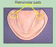 Action of these muscles limit the extent of denture,& prevents placement of extra pressure on distal part of pad during impression, The anterior section is