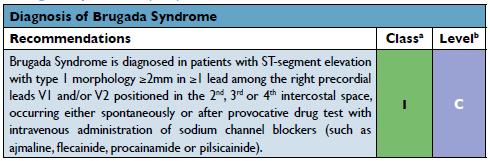 Brugada Syndrome (BrS): Diagnosis NEW DIAGNOSTIC CRITERIA Incidence Prevalence of