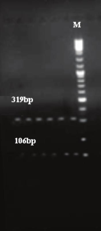 Southeast Asian J Trop Med Public Health a b Fig 1 PCR-RFLP analysis of H. pylori 23S rrna for detection of A2143G mutation.