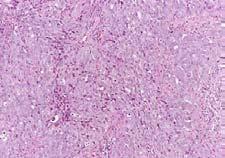 carcinomas are not well characterized It