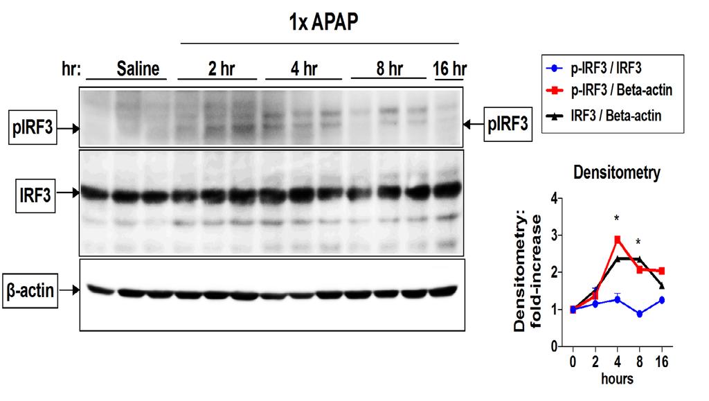 APAP liver injury results in phosphorylation of IRF3 Iracheta-Velle