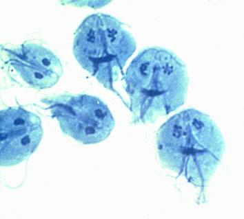 Water Borne Infectious Diseases: Protozoa Giardia lamblia