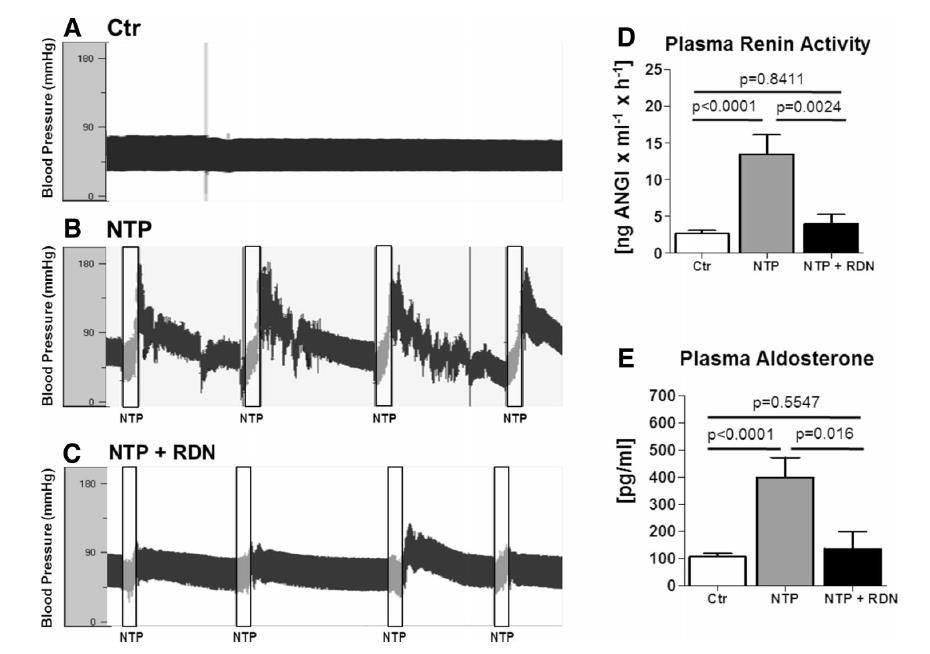 OSA-Related Atrial Arrhythmias Effect of RSDN Porcine model of Obstructive Sleep Apnea Tracheostomy and application of negative